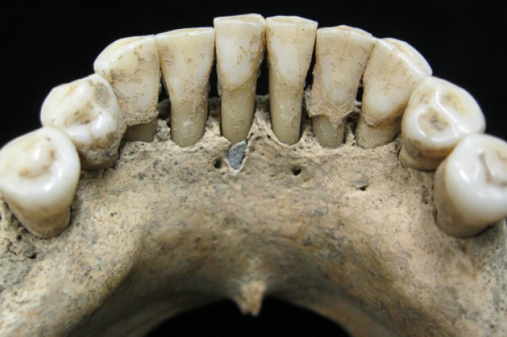 A fleck of lapis lazuli found in the lower jaw of a female skeleton from the 11th or 12th century, Photo: Christina Warinner